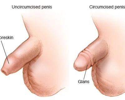 切包皮的明星,揭秘那些勇敢割包皮的明星